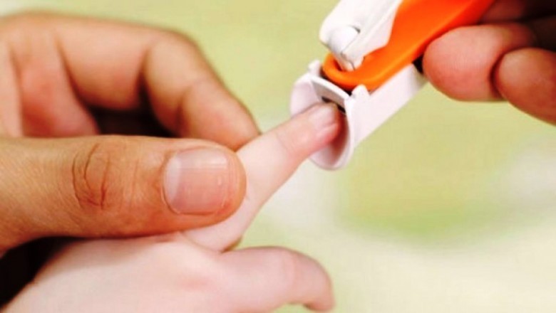 Tırnağı Çok Derin Kesmemek