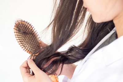 Bayanlarda Saç Dökülmesi - Hair Loss in Women